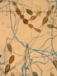 Alternaria