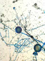 Rhizopus