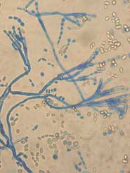 Penicillium Digitatum