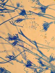 Penicillium Olsonii