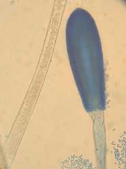 Aspergillus Clavatus