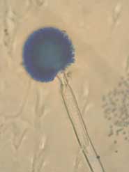 Aspergillus Niger