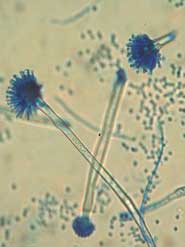 Aspergillus Versicolor