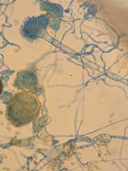 Aspergillus Eurotium Amsterdami