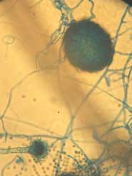 Aspergillus Eurotium Chevalieri